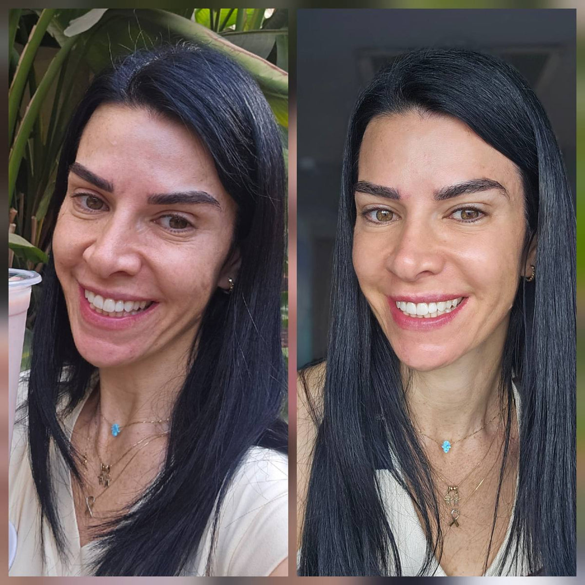 תוצאות לקוחה 3